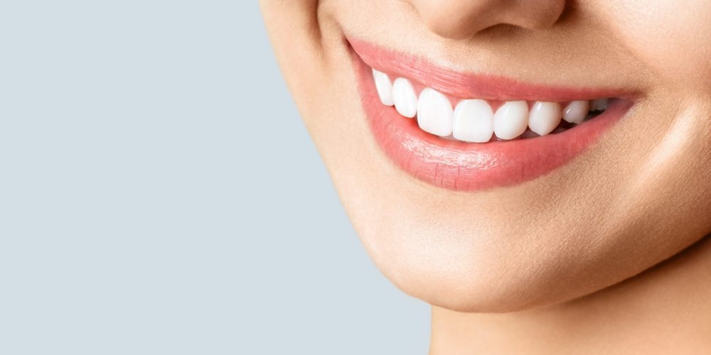 Beautiful,Female,Smile,After,Teeth,Whitening,Procedure.,Dental,Care.,Dentistry